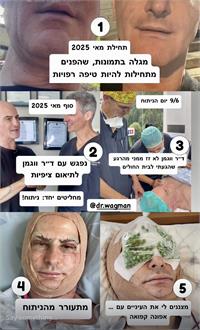 תיעוד בגוף ראשון