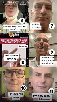שלבי ההחלמה